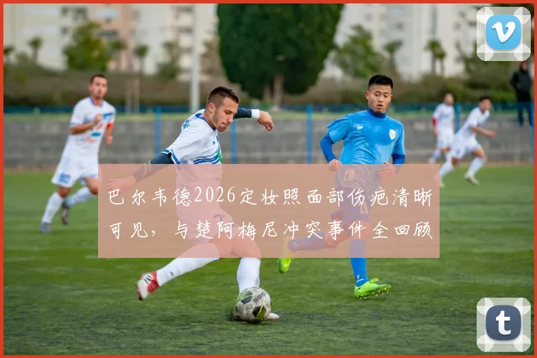 巴尔韦德2026定妆照面部伤疤清晰可见，与楚阿梅尼冲突事件全回顾与皇马内部处理解读