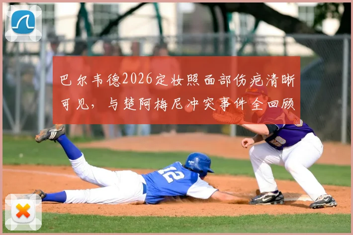 巴尔韦德2026定妆照面部伤疤清晰可见,与楚阿梅尼冲突事件全回顾与皇马内部处理解读